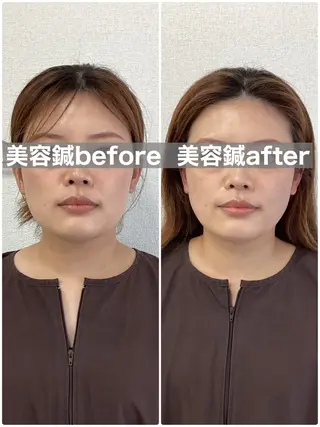 ハリサロンドオフ 美容鍼灸×小顔整体のエステ・リラクイメージ