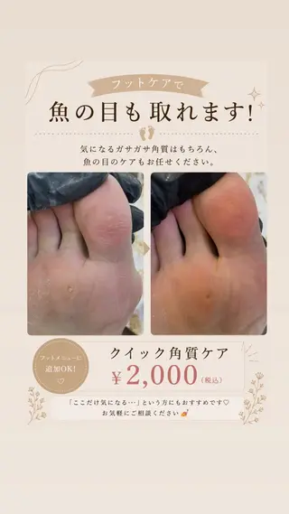 ネイル パーツたくさん🍓 SUMIのネイルデザイン