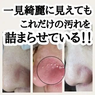 毛穴専門店 マカナアロハのエステ・リラクイメージ