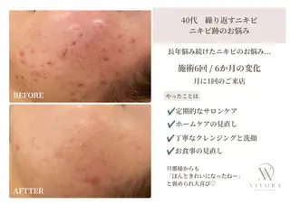 VIVORA ASAMI🌿のエステ・リラクイメージ