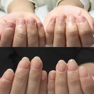 ネイル 自爪育成・巻き爪 補正講師 津蔵のネイルデザイン
