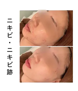 ハーブピーリング専門 BIOPLUS+川崎のエステ・リラクイメージ