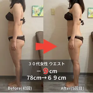 骨盤矯正ダイエット ぷりんす整体COZYのエステ・リラクイメージ