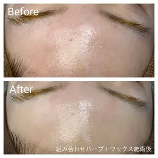 深い肌悩み&早期脱毛 完了サロンのエステ・リラクイメージ