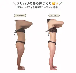 《本気痩せ×疲労改善 》  BILOOPのエステ・リラクイメージ