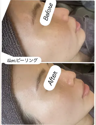 看護師 桐山 まどかのエステ・リラクイメージ