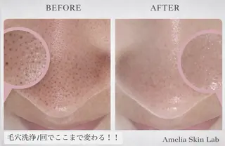 医療提携サロン 毛穴・ニキビケアのエステ・リラクイメージ