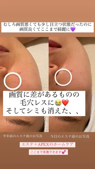 salon aretéのエステ・リラクイメージ