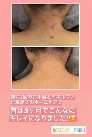 ミディアム カラー パーマ ヘアアレンジ メンズ キッズ ネイル マツエク・マツパ ニキビ・肌質改善専門 ♡人生が変わるサロンのエステ・リラクイメージ