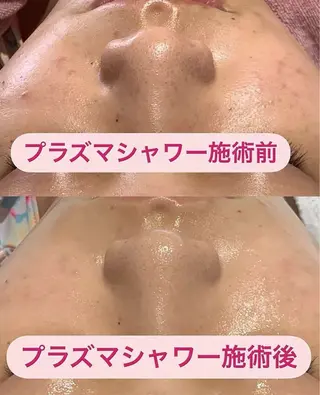 ネイル 愛維美水光専門店 川崎彩鳳のエステ・リラクイメージ
