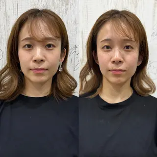 恵比寿/代官山 鍼灸師/根本亮佑のエステ・リラクイメージ