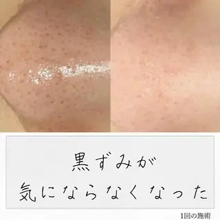 ニキビ経験者が施術 する専門サロン🌻のエステ・リラクイメージ