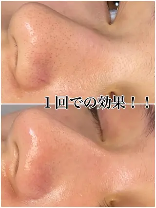 メンズ ネイル マツエク・マツパ +belle プリュベルのエステ・リラクイメージ