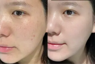 マツエク・マツパ 愛維美水光専門店 川崎彩鳳のエステ・リラクイメージ