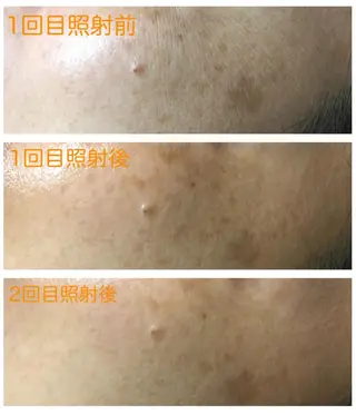 salon de epilaのエステ・リラクイメージ