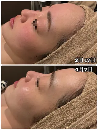 Dione 立川店のエステ・リラクイメージ