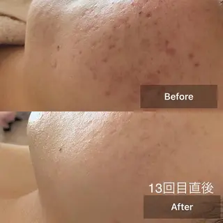 メンズ キッズ 美肌と癒しのサロン Lu,Mieのエステ・リラクイメージ