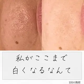 ニキビ経験者が施術 する専門サロン🌻のエステ・リラクイメージ