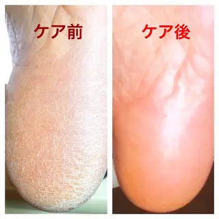 メンズ ネイル 🌱 ま し お 🌱のその他イメージ