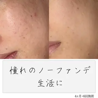 ニキビ経験者が施術 する専門サロン🌻のエステ・リラクイメージ