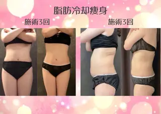 マツエク・マツパ 愛維美水光専門店 川崎彩鳳のエステ・リラクイメージ