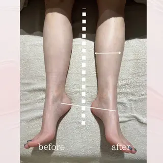肌管理サロン vidyto　MOEのエステ・リラクイメージ