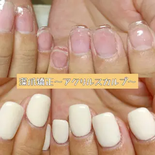 ネイル 深爪矯正/爪育成ケア manie nailのネイルデザイン