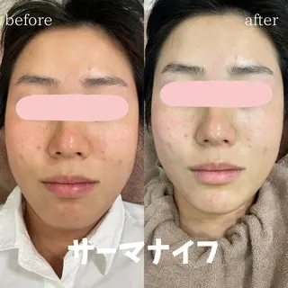 mish eyebrowのエステ・リラクイメージ