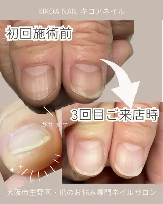 ネイル KIKOA NAIL キコアネイルのネイルデザイン