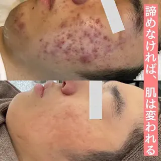岡崎🦋SOYOU 韓国肌管理のエステ・リラクイメージ