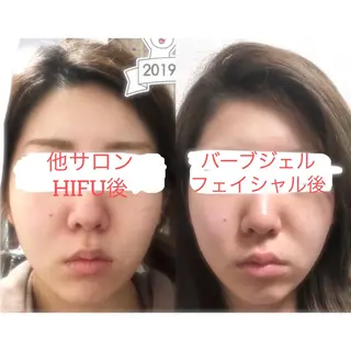a  room salonのエステ・リラクイメージ
