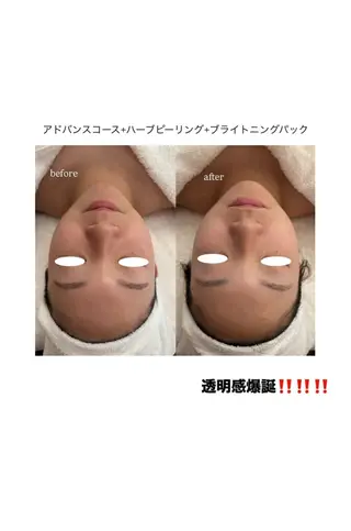 メナード MIYUのその他イメージ