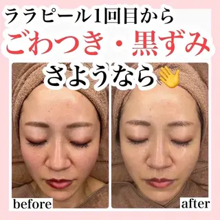 韓国肌管理🫧艶肌 ニキビケア🩵本町店のエステ・リラクイメージ