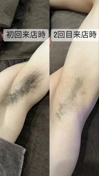 パーソナル脱毛 GROOMのエステ・リラクイメージ