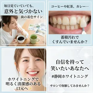 ホワイトニング ショップ葵区静岡駅店のその他イメージ