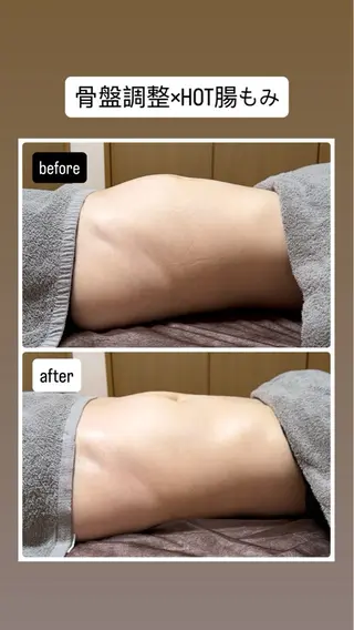 lymph coconのエステ・リラクイメージ