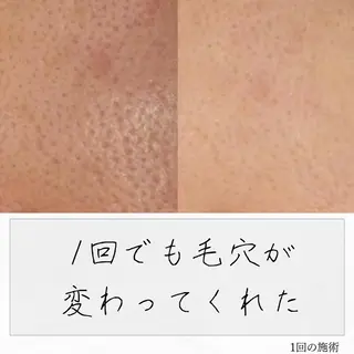 ニキビ経験者が施術 する専門サロン🌻のエステ・リラクイメージ