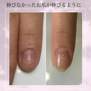 ネイル 雀宮 自爪育成 Re.nail〜寺本のネイルデザイン