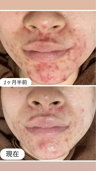 桐山 まどかのエステ・リラクイメージ