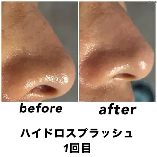 ネイル・エステサロン UILANIのエステ・リラクイメージ
