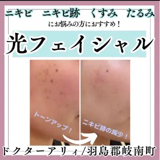 Dr.ALII 岐南店　鈴村のエステ・リラクイメージ