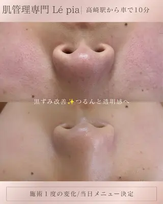 肌質管理専門店 Lé pia AMIのエステ・リラクイメージ