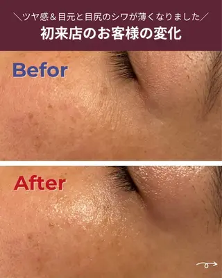 肌質改善エステ RISMINのエステ・リラクイメージ