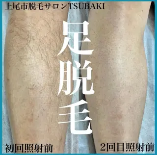 メンズ TSUBAKI上尾店 松下のエステ・リラクイメージ
