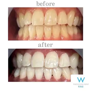 メンズ キッズ ホワイトニング ショップ町田店のその他イメージ