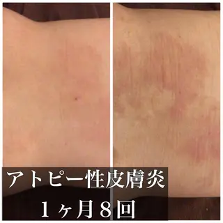 ミディアム カラー パーマ ヘアアレンジ メンズ キッズ ネイル マツエク・マツパ ニキビ・肌質改善専門 ♡人生が変わるサロンのエステ・リラクイメージ