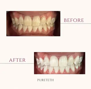 ホワイトニングサロン PURETETHのエステ・リラクイメージ