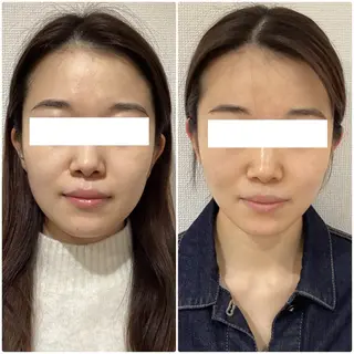 💎小顔サロン アリリン銀座💎のエステ・リラクイメージ