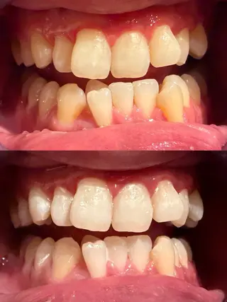 écrusmile ホワイトニングサロンのその他イメージ