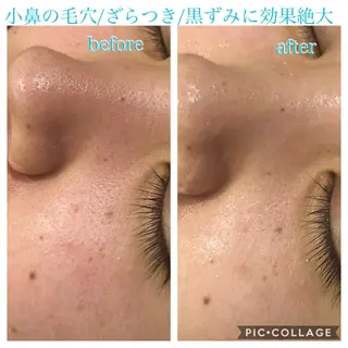 ミディアム カラー パーマ ヘアアレンジ キッズ ネイル マツエク・マツパ EnsorClair 代表 野口真央のエステ・リラクイメージ